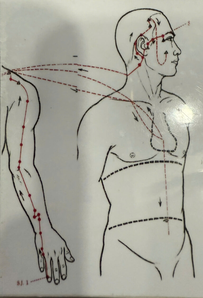 Thủ Thiếu Dương Tam Tiêu